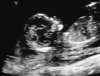 13_5 Weeks.png