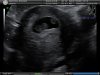 7 WEEKS_6.JPG