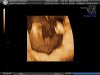BABY_14.JPG
