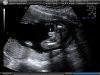BABY_2.JPG