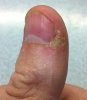 thumb.jpg