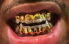 gold teeth.png