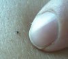 Lyme_Tick_1.JPG