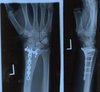 xray.jpg