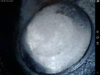 Cyl 4 exhaust valve.png